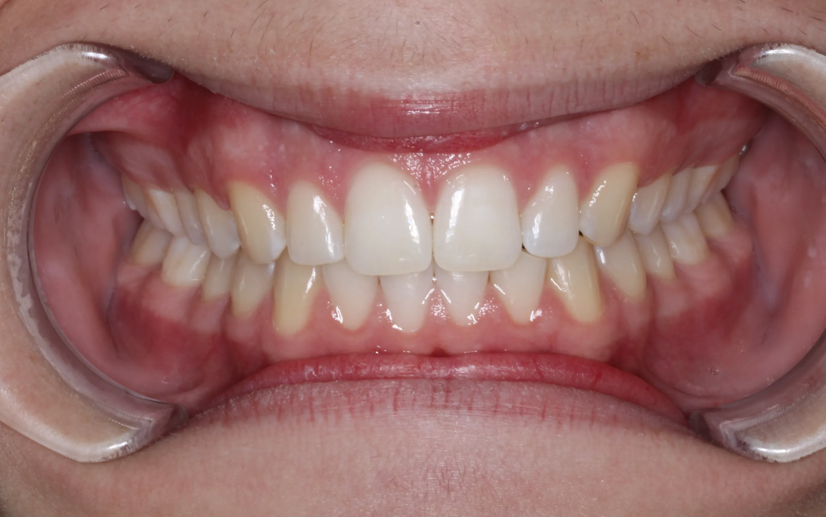 smile-gallery gallery